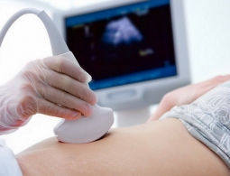 Ученые назвали фактор, снижающий шансы женщин забеременеть