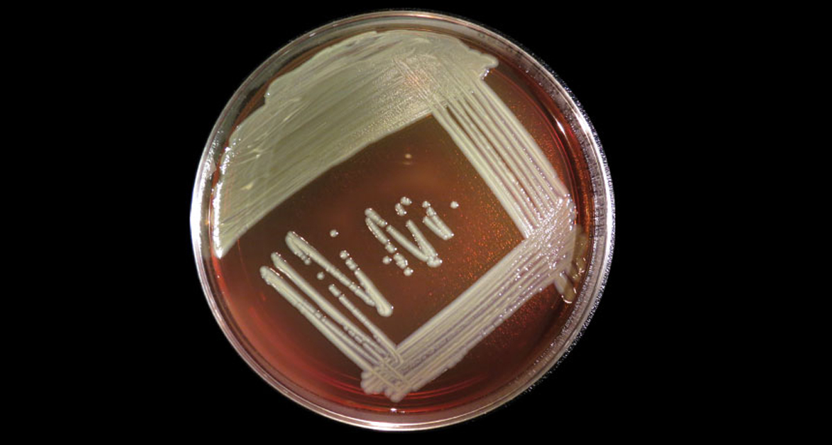 Бактерия, считавшаяся безвредной, вызвала смертельную инфекцию