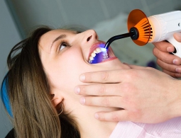 Ученые создали биопломбу для регенерации зубов