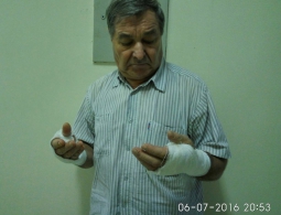 В Брянске бешеный пес растерзал таксу и покусал хозяина