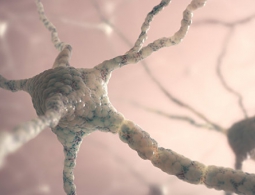 Ученые впервые применили стволовые клетки для лечения инсульта