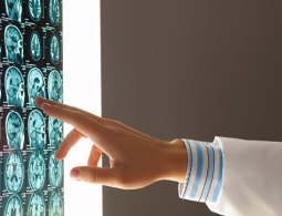 Ученые из России выяснили, как стресс влияет на болезни мозга