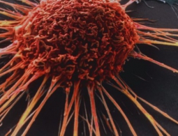 Искусственный интеллект от Microsoft поможет лечить рак