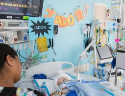 В США проведена уникальная операция по разделению сиамских близнецов, сросшихся головами