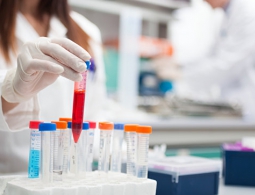 Медики создали лекарство, блокирующее передачу ВИЧ половым путем