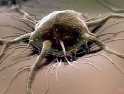 Российские онкологи создали соединение, способное побеждать даже устойчивые к химиотерапии опухоли