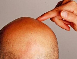 Создан охлаждающий шлем, который спасет от потери волос при химиотерапии