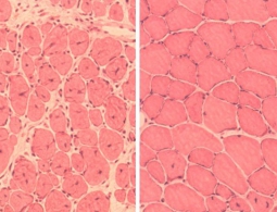Ученые впервые омолодили целое животное стволовыми клетками