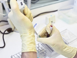 Роспотребнадзор сообщил о вспышке гепатита А в Европе