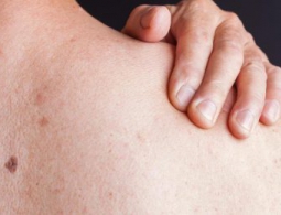 Что делать людям, которые никогда не чувствуют боли?