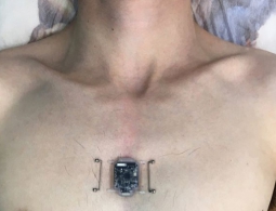 Новосибирский программист установил себе компас-имплант