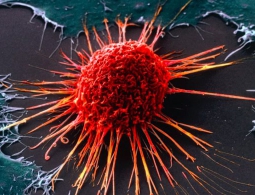 Новый тест позволит выявить рак за 10 лет до его появления