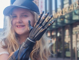 В Великобритании начались клинические испытания бионических протезов