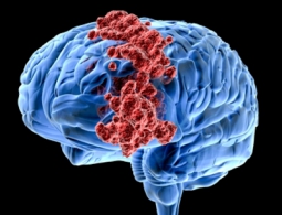 Медики победили опухоль мозга препаратом от малярии