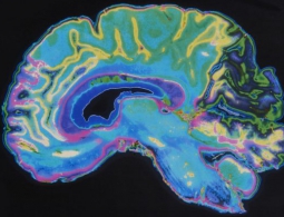 Искусственный интеллект научился выявлять ранние симптомы шизофрении