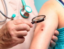 Победить меланому поможет… брокколи