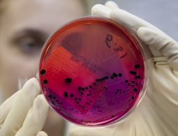 Обнаружен новый опасный штамм сибирской язвы