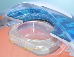 Дополненную реальность теперь можно имплантировать прямо в глаза