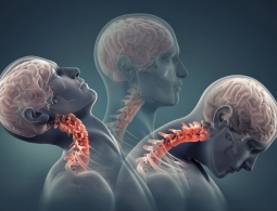 Китайской пациентке вживили напечатанные на 3D-принтере позвонки