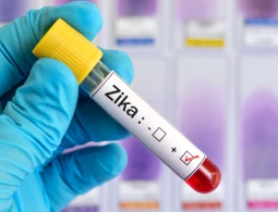 В США предлагают использовать вирус Зика для борьбы с раком