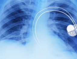 Исследователи создали гибкую органическую батарею для медицинских имплантатов