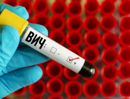 Учёные создали иммунные клетки, способные дать отпор ВИЧ