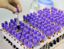 Найден простой способ борьбы с ожирением