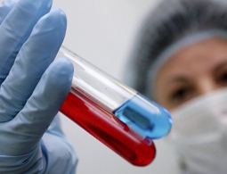 Лекарство от рака лечит от ВИЧ, выяснили врачи