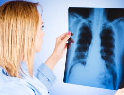 Найден способ определить рак легких по составу выдыхаемого воздуха