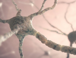 Названа главная причина слабоумия