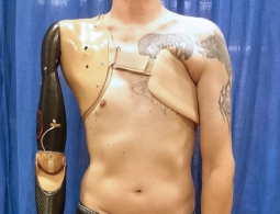 Создан протез, который управляется сигналами нервов спинного мозга