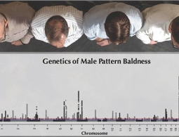 Генетики научились предсказывать, как сильно полысеет мужчина в 40 лет