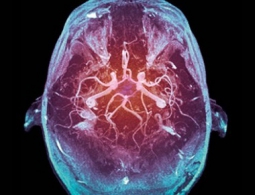 Улучшение мозга сделает нас «менее человечными»