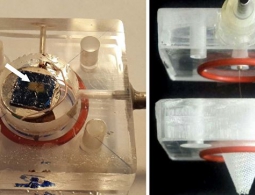 Биологи из России научились обнаруживать туберкулез по дыханию человека