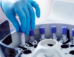 Биологи связали африканскую "зомби-болезнь" с червем-паразитом