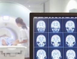 Мыслить как преступник. Правонарушителей можно вычислить по снимку мозга