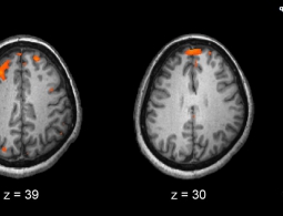 Мозг: переосмыслить, чтобы понять