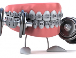 В США начались испытания системы, способной заменить брекеты