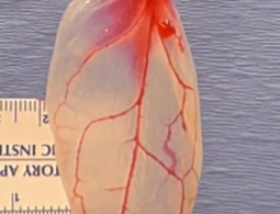 В Великобритании из шпината вырастили аналог мышечной ткани с капиллярами