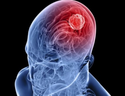 Учёные научились подсвечивать раковые клетки в процессе удаления опухолей