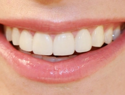 Учёные научились регенерировать повреждённые ткани зубов