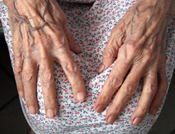 Нобелевский лауреат назвала пять легких способов замедлить старение