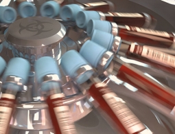 "У каждого человека свой тип крови". Почему не бывает универсальных доноров