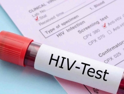 Новая вакцина от ВИЧ показала хорошие результаты в испытаниях на людях