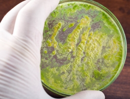 Медики предупредили об угрозе супербактерии, вызывающей бесплодие