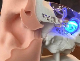 Созданы импланты, возвращающие слух