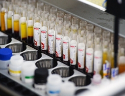 Названы главные смертельные угрозы человечеству в XXI веке