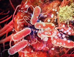 Российские ученые разработали высокочастотную «пушку» для лечения рака